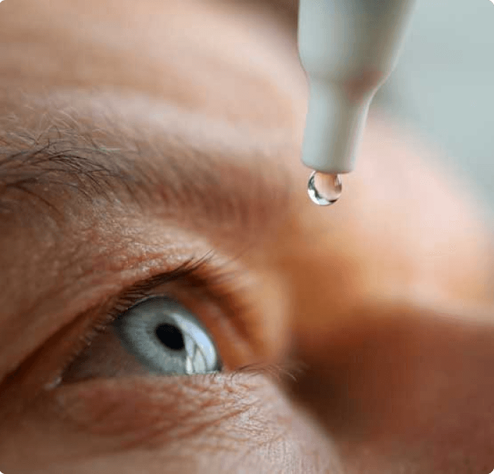 Glaucoma eye drops