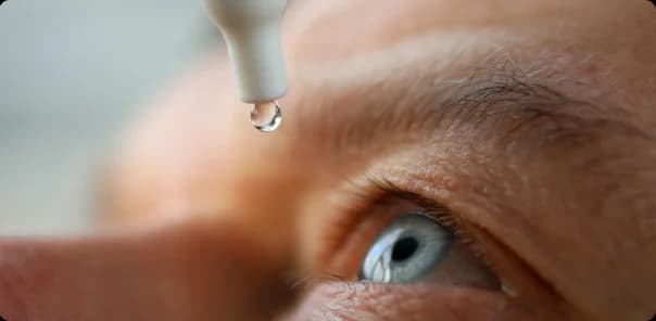 Viral Conjunctivitis