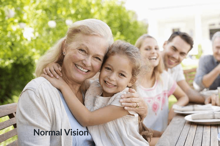 Demonstration of normal vision without glaucoma symptoms.